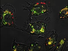 Tack vare sfäriska nukleinsyror var substansen 5-fluorouracil 20 000 gånger mer effektiv än vanligt i djurstudier. (Bildkälla: Northwestern University)