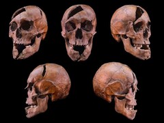 Den undersökta personens skalle från dominikanklostret på 1200-talet på Margaret Island i Budapest (Image Credit: Eötvös Loránd University)