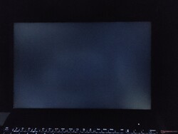 Måttlig blödning i bakgrundsbelysningen (visas förbättrad här)