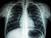 En röntgenbild av en mänsklig torso (Bildkälla: Umanoide via Unsplash; beskuren)