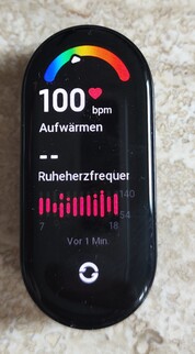 Testa Xiaomi Mi Smart Band 7