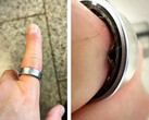 En Samsung Galaxy Ring med ett svullet batteri tvingade en användare att uppsöka sjukhus. (Bildkälla: Zone of Tech)