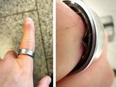 En Samsung Galaxy Ring med ett svullet batteri tvingade en användare att uppsöka sjukhus. (Bildkälla: Zone of Tech)