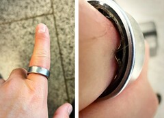 En Samsung Galaxy Ring med ett svullet batteri tvingade en användare att uppsöka sjukhus. (Bildkälla: Zone of Tech)