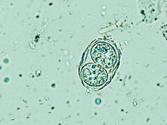 Toxoplasma gondii visas här i sin infektiösa äggliknande form. (Bildkälla: Todorean Gabriel/iStock/Getty Images Plus)