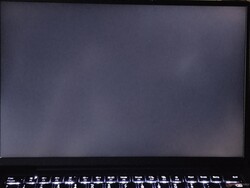 Måttlig blödning i bakgrundsbelysningen (visas förbättrad här)