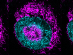 En innesluten cancercell (bilden) - de magentafärgade mitokondrierna kan ses ansamlas vid den cyanfärgade kärnans periferi och i kärnans fördjupningar. (Bild/skildringskälla: Rito Ghose och Fabio Pezzano/Centro de Regulación Genómica)