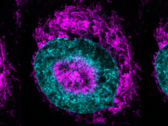 En innesluten cancercell (bilden) - de magentafärgade mitokondrierna kan ses ansamlas vid den cyanfärgade kärnans periferi och i kärnans fördjupningar. (Bild/skildringskälla: Rito Ghose och Fabio Pezzano/Centro de Regulación Genómica)