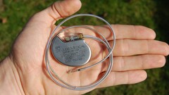 En traditionell pacemaker. (Bildkälla: Wikimedia Commons)