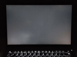 Måttlig blödning i bakgrundsbelysningen (visas förbättrad här)